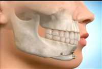 دکتر شهرام طاهریان | جراح دهان، فک و صورت